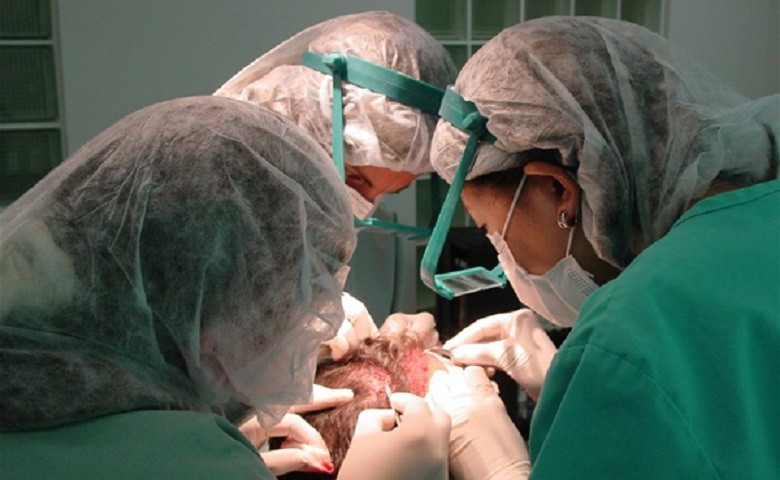 hair transplant surgeon