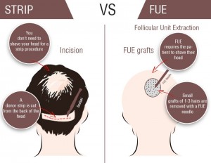 fue vs fut hair transplant in Abu Dhabi