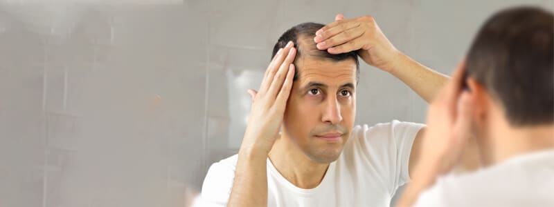 Baldness treatment in Dubai